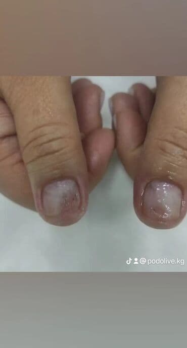 маникюр педикюр с выездом на дом: Коррекция вросших ногтей, Выравнивание, Услуги подолога, Маникюр, Педикюр, С выездом на дом, Консультация, Одноразовые расходные материалы — 6