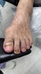 арендовать дом: Выравнивание, Услуги подолога, С выездом на дом, Консультация, Одноразовые расходные материалы — 30