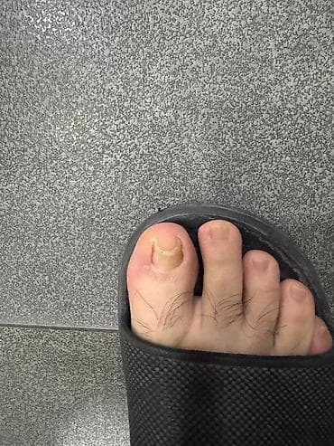 орт книжки: Коррекция вросших ногтей, Услуги подолога, С выездом на дом, Консультация, Одноразовые расходные материалы — 9