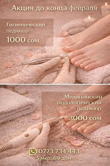 фе: Услуги подолога Профессиональная обработка стоп и ногтей: - Вросшие — 2