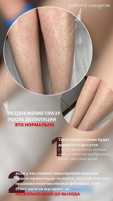 ищу работу шугаринг: ✨ ГЛАДКАЯ КОЖА — MUST HAVE ЭТОГО ЛЕТА ☀️ Шугаринг — это про комфорт — 1