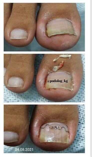 сколько стоит обучение на маникюр: Выравнивание, Наращивание ногтей, Донаращивание ногтей, Маникюр, Педикюр, Услуги подолога, Консультация, Одноразовые расходные материалы — 3