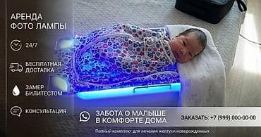 Медициналык лампалар: Фотолампа от желтушки в аренду. Самая эффективная, сверхъяркая — 5