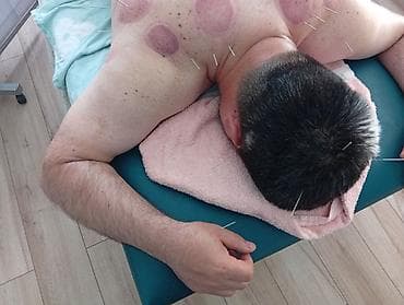 Массаж | Лечебный массаж | Сутулость, нарушение осанки