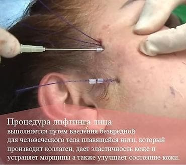 липолитик: Все косметологические процедуры, лечение угревой болезни, #нитевой — 3