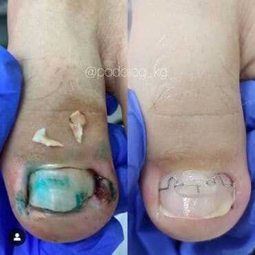 маникюр педикюр с выездом на дом: Выравнивание, Наращивание ногтей, Донаращивание ногтей, Маникюр, Педикюр, Услуги подолога, С выездом на дом, Консультация, Одноразовые расходные материалы — 7