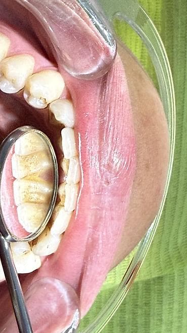 стоматология кабинет: Акция Акция Акция до конца мая! Серьезно, ребята, до конца мая — 2