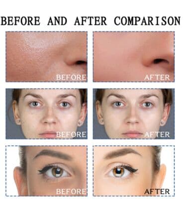 корейские бады день и ночь отзывы: ❄️ США Сыворотка отбеливающая от веснушек и пигментных пятен а так же — 9