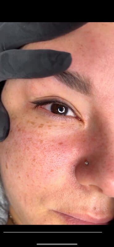 самый лучший эндокринолог рядом просп жибек жолу бишкек: Брови, Стрелки, Теневая растушевка, Удаление татуажа, Гипоаллергенные материалы, С выездом на дом, Консультация — 1