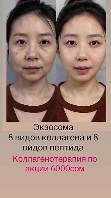ава терапия: Коллагенотерапия и уход с экзосомами, пептидами и 8 видами коллагена — 2