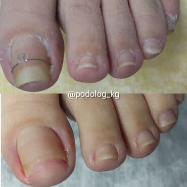 сколько стоит обучение на мастера маникюра: Коррекция вросших ногтей, Маникюр, Педикюр, Услуги подолога, Консультация — 11