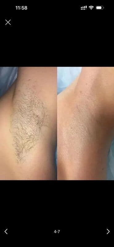 хороший дерматолог в бишкеке отзывы: Шугаринг, С выездом на дом — 3