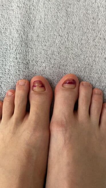 самый лучший эндокринолог рядом просп жибек жолу бишкек: Воосшие ногти, заболевания ногтей, стопы, бородавки, мозоли — 15