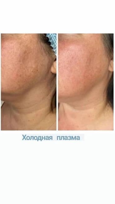 самый лучший эндокринолог рядом просп жибек жолу бишкек: Косметология, Ботокс, Биоревитализация, Ботулинотерапия, Консультация, Гипоаллергенные материалы, Сертифицированный косметолог — 6