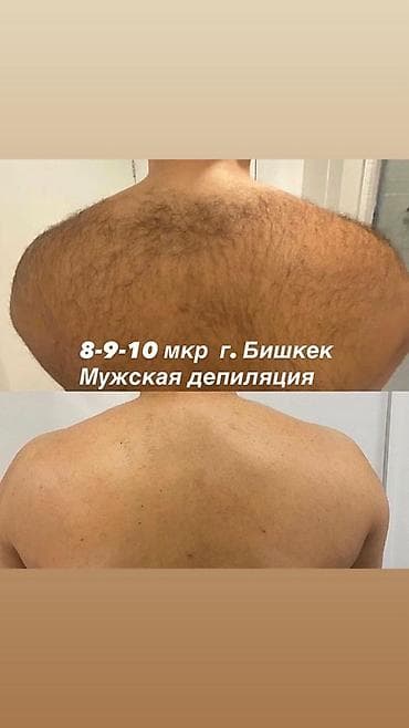 алерана спрей бишкек: Извращенцы проходите мимо ! Только депиляция и ничего более! г — 1
