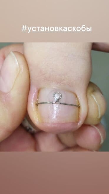 Дизайн, Тырмак өстүрүү, Шеллак, Маникюр, Педикюр, Подолог кызматтары, Консультация, Бир жолку сарпталуучу материалдар lalafo.kg да Дизайн, Тырмак өстүрүү, Шеллак, Маникюр, Педикюр, Подолог кызматтары, Консультация, Бир жолку сарпталуучу материалдар