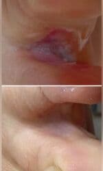 арендовать дом: Выравнивание, Услуги подолога, С выездом на дом, Консультация, Одноразовые расходные материалы — 16