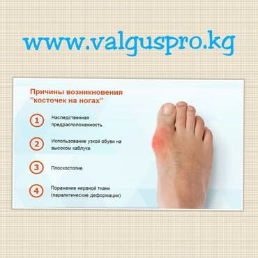 накладки для ног: Корректоры для большого пальца ноги от вальгусной деформации(косточки — 3