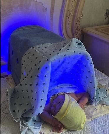 Медтовары: Аренда оборудования для фототерапии новорожденных (желтушка) Услуги: - — 3