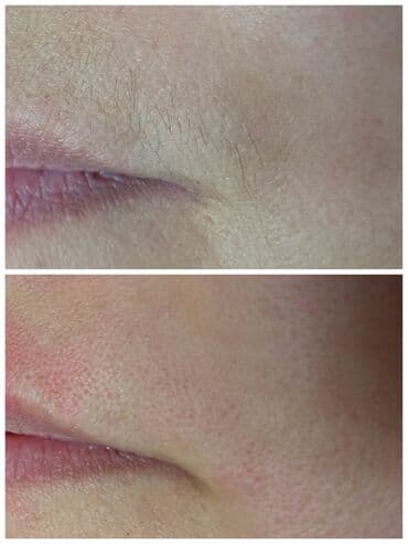 кож: Косметология, Маски, Массаж лица, Отбеливание пигментных пятен, Консультация, Гипоаллергенные материалы, Сертифицированный косметолог — 10