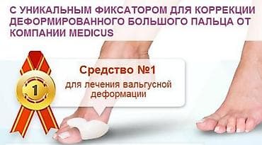 Корректоры для большого пальца ноги от вальгусной деформации(косточки lalafo.kg да Корректоры для большого пальца ноги от вальгусной деформации(косточки