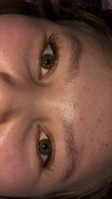 сколько стоит поставить брекеты на зубы в бишкеке: Наращивание ресниц - Классическое и объемное наращивание с — 4