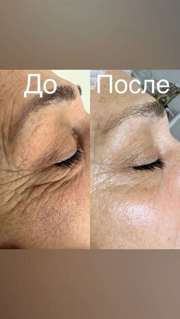 частный роддом бишкек цены: Косметология, Пилинг, Ботулинотерапия, Плазмолифтинг, Консультация, Требуются модели, Сертифицированный косметолог — 6