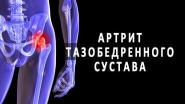 эко спрей от вшей как пользоваться: Бишофит от чего помогает. опорно-двигательного аппарата — 4