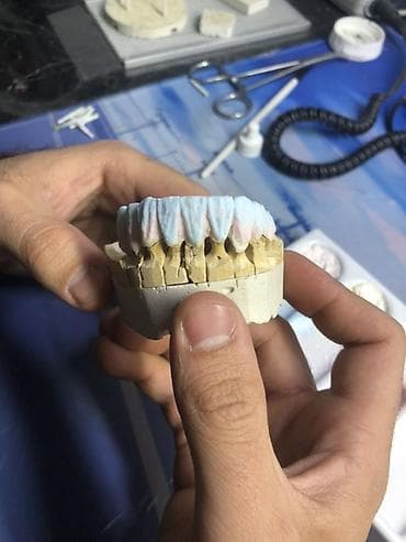 Швейное дело: Зуботехнические работы: изготовление несъёмных ортопедических — 3