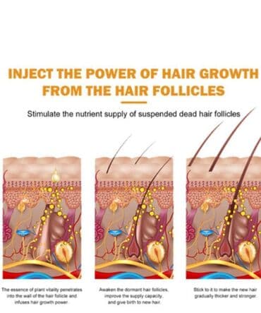 от выпадения волос: ❄️ США Аргановое масло миноксидил касторовое масло биотин От — 8