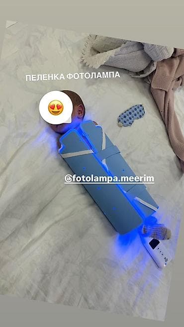 коляса: Аренда фотоламп для новорождённых (терапия неонатальной желтухи) — 6