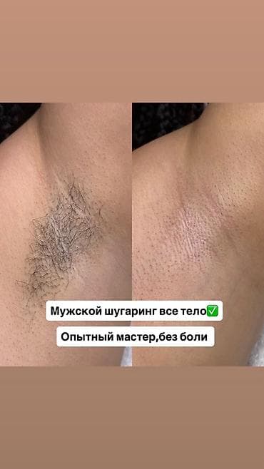 Мужской шугаринг – все зоны тела. - Шугаринг для мужчин: подмышки