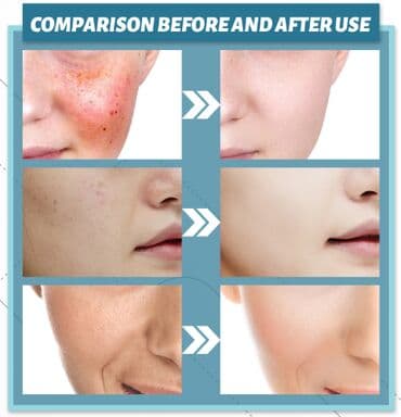 корейские бады день и ночь отзывы: ❄️ США Крем с керамидами антивозрастной увлажняющий Крем с керамидами — 8