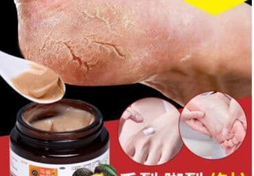 личный кабинет эрсаг кыргызстан: 🔥 Заживитель трещин . Шикарное средство — 2