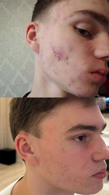 медицинский массаж курсы: Косметология, Демодекоз, Контурное моделирование, Лечение угревой болезни, Консультация, Гипоаллергенные материалы, Сертифицированный косметолог — 17