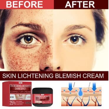 шампунь дисаар: ❄️ США Крем интенсивный отбеливающий антивозрастной с Еbay Аmazon — 14