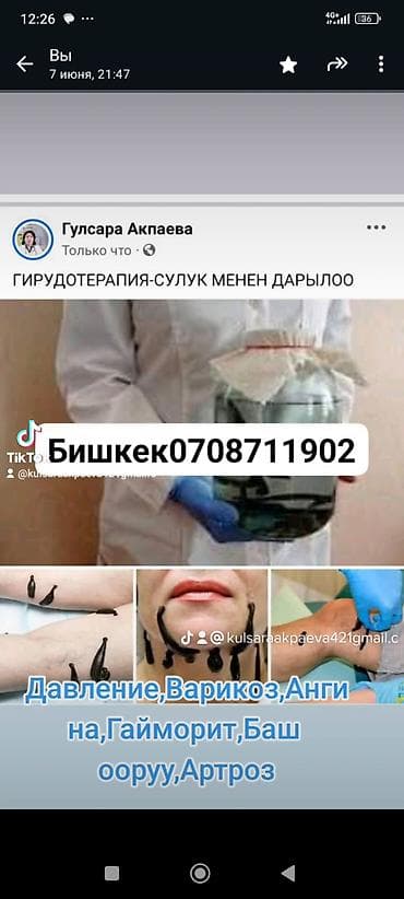 raspberry pi 4: Врачи | Гирудотерапевт | Лечение пиявками — 8