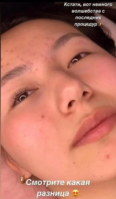 iohone x: Ресницы, Классика, Гипоаллергенные материалы — 6