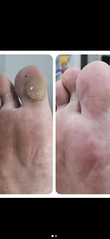 nex 3: Выравнивание, Дизайн, Донаращивание ногтей, Маникюр, Консультация — 2