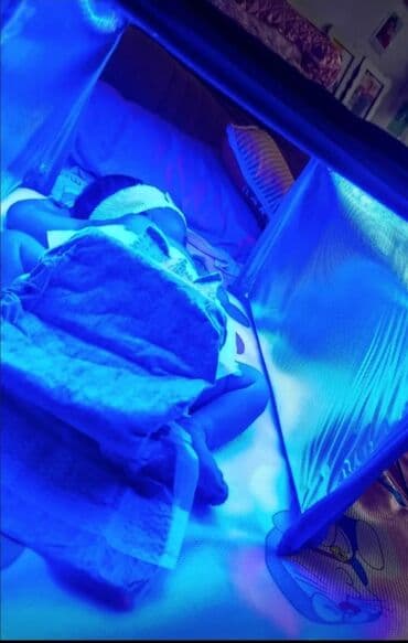 Фото лампа для желтуха арендага берилет кунуно 300-сомдон