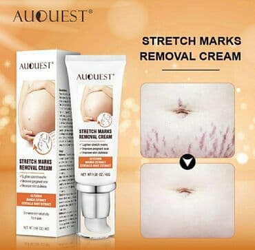 растяжки: Крем для удаления растяжек AUQUEST. Можно убрать растяжки на теле — 2