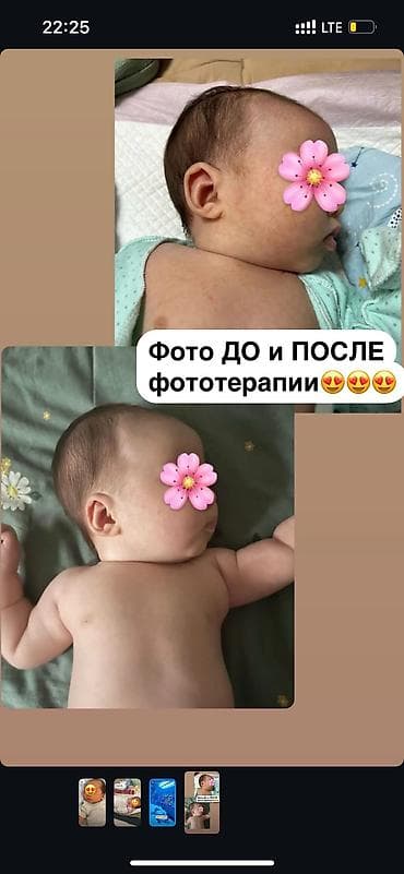 корейские маски: Фотолампа. Желтуха. Аренда лампы Маска для защиты глаз в комплекте 🎁 — 2