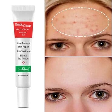 крем день и ночь китайский отзывы: Лечащий крем против акне и шрамов после угрей на основе чайного дерева — 3