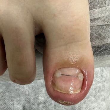 сколько стоит обучение на мастера маникюра: Коррекция вросших ногтей, Маникюр, Педикюр, Услуги подолога, Консультация, Одноразовые расходные материалы — 19