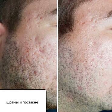 частный роддом бишкек цены: Косметология, Пилинг, Ботулинотерапия, Плазмолифтинг, Консультация, Требуются модели, Сертифицированный косметолог — 12