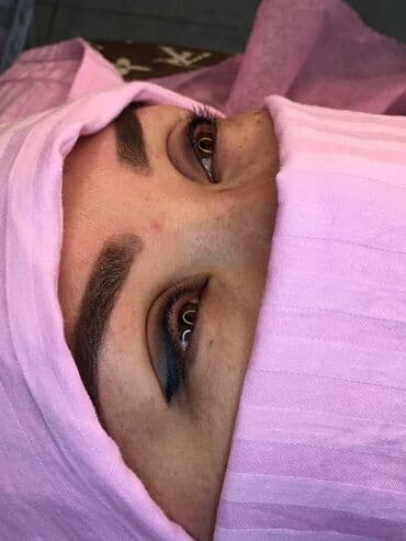 сангапури: Косметология, Маски, Биоревитализация, Ботокс, С выездом на дом, Консультация, Гипоаллергенные материалы — 2