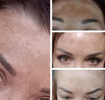 эффективный отбеливающий крем для зоны бикини в аптеке: Expigment Экспигмент Сроки до 2027 Свежая поставка с Турции 🇹🇷 💯% — 12