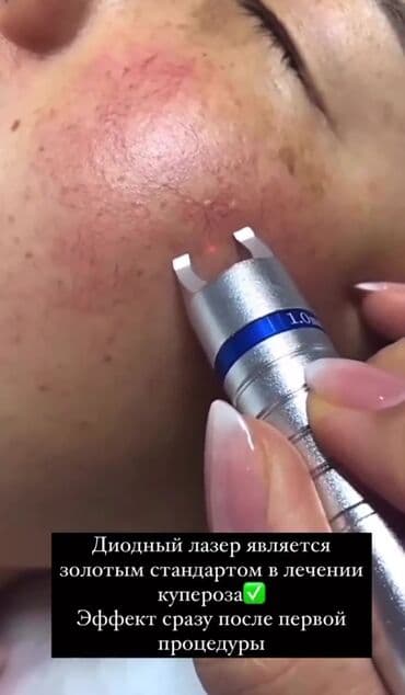 самый лучший эндокринолог рядом просп жибек жолу бишкек: Косметология, Ботокс, Биоревитализация, Ботулинотерапия, Консультация, Гипоаллергенные материалы, Сертифицированный косметолог — 2