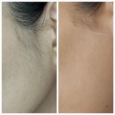 пилинг для мужчин: Восковая депиляция для женщин и мужчин Подмышки - 500 сом — 3