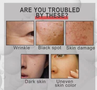 корейские капсулы день ночь отзывы: ❄️ США Сыворотка антивозрастная с полипептидами женьшеня разработана — 8